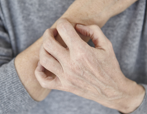 Old woman scratching hands with dry skin