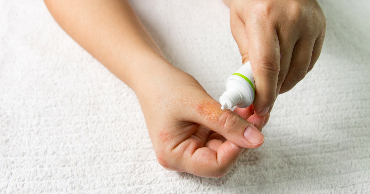 Dead Sea Salt For Eczema Benefits And How To Use, 53 OFF