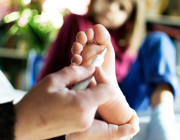 Main appliquant un médicament sur le pied d'une jeune fille pour traiter une verrue